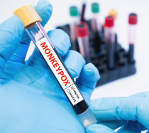 Image of a monkeypox test.
